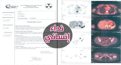 نداء إنساني لمساعدة شابة تعاني من سرطان الدم قصد إجراء عملية جراحية