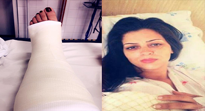 أمال صقر في المستشفى بسبب كسر خطير على مستوى ساقها 